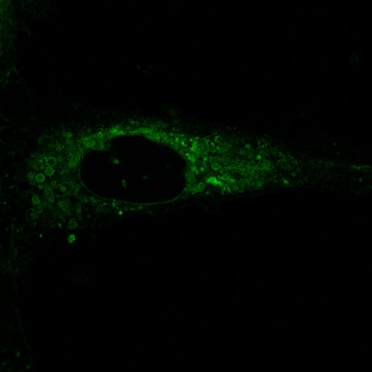 Microscope images of fluorescing cells captured by researcher Kirsty Muirhead