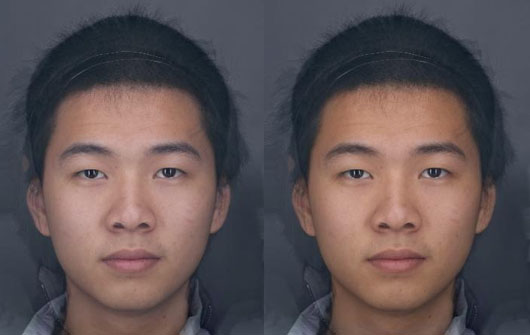 Improved skin colour in an Asian face following an increase in fruit and veg for a 6 week period
