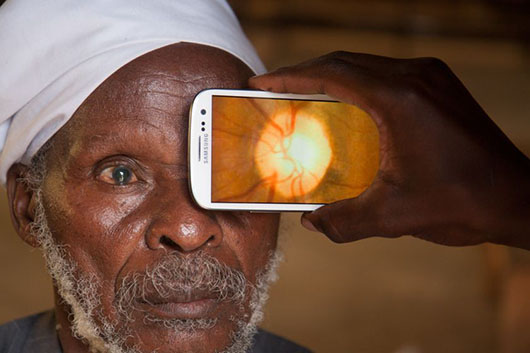 A man from Nakuru, Kenya, having his retina imaged for optic nerve diseases by the Peek smartphone tool. Credit: Peek.