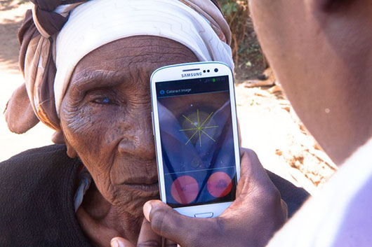 A woman from Nakuru, Kenya, having a cataract scan with the Peek smartphone tool. Credit: Peek.