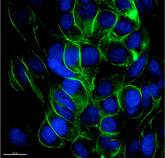 The new biologic (green) binding to the surface of cells (blue nuclei), protecting the cells from invasion by the influenza virus.
