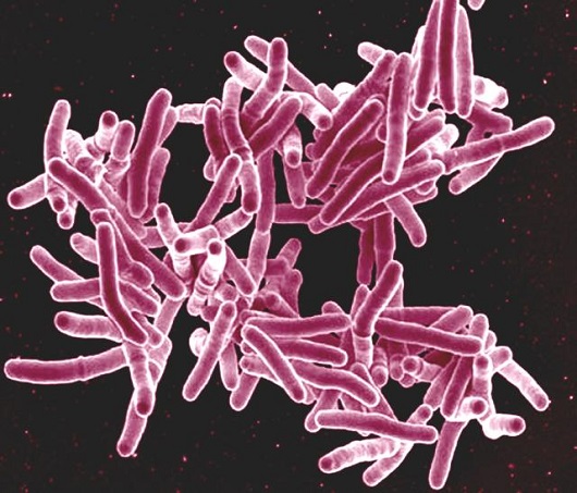 TB Bacteria
