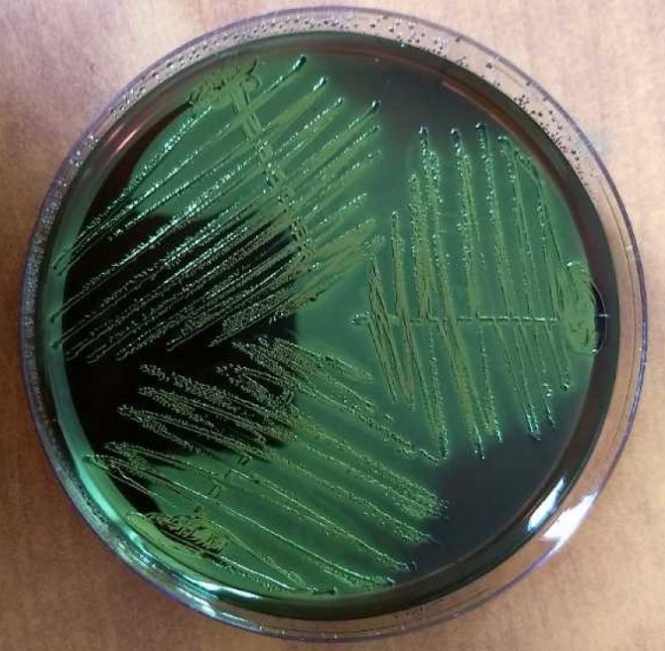 bacteria-on-agar-plates