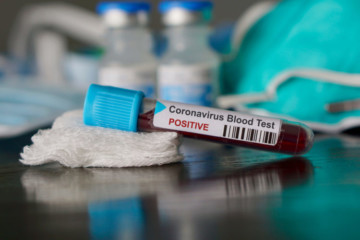 Test tube with blood inside and coronavirus positive written on it