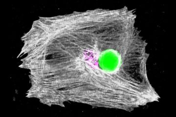 Feel the beat: implanted microlasers scan heart from inside