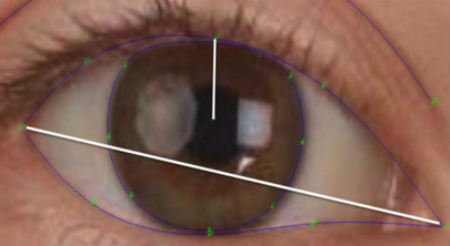 Eyelid openness calculation