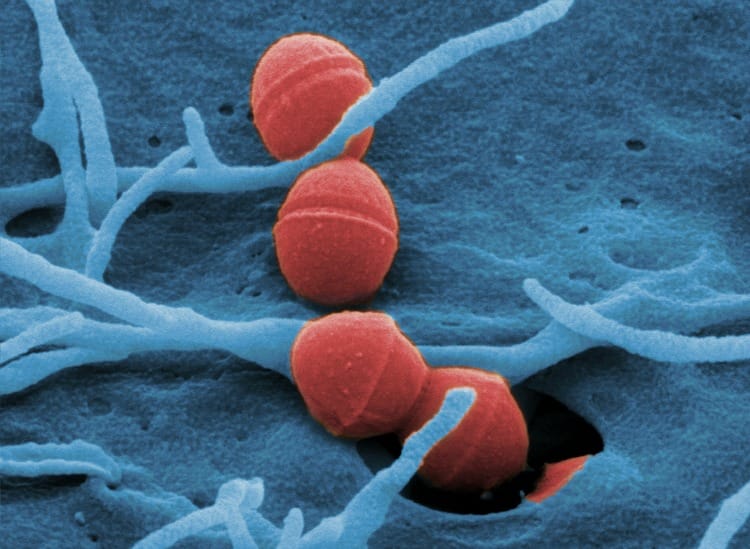 Lactococcus equipped with chemical harpoon 