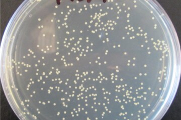 A sample of MRSA bacteria - Dr Jo Hobbs